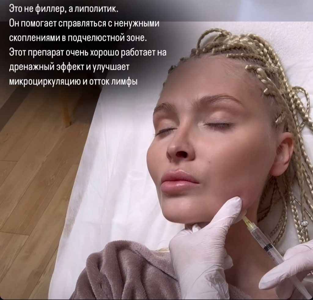 Алену Шишкову заподозрили в пластике